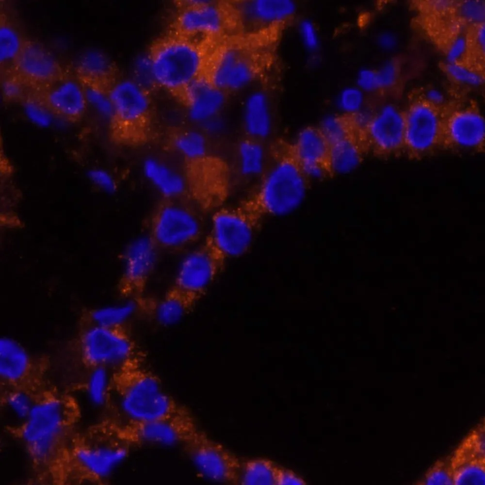 Rabbit anti-NF2 IHC Antibody, Affinity Purified