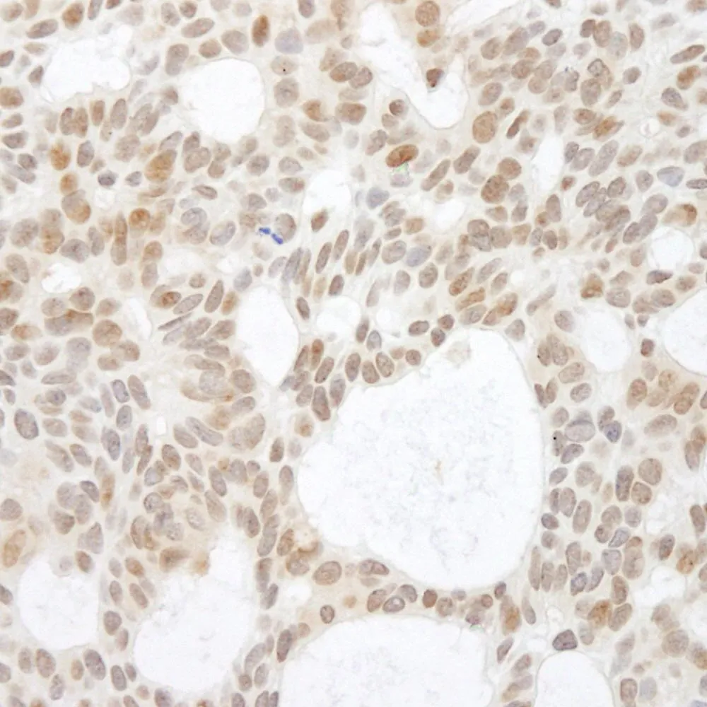 Rabbit anti-p73 IHC Antibody, Affinity Purified