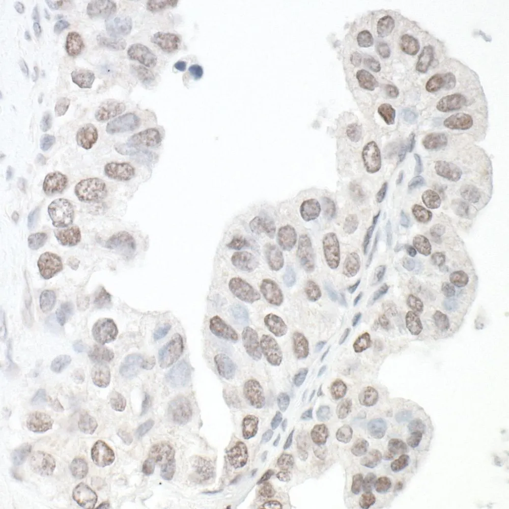 Rabbit anti-SMC6 IHC Antibody, Affinity Purified