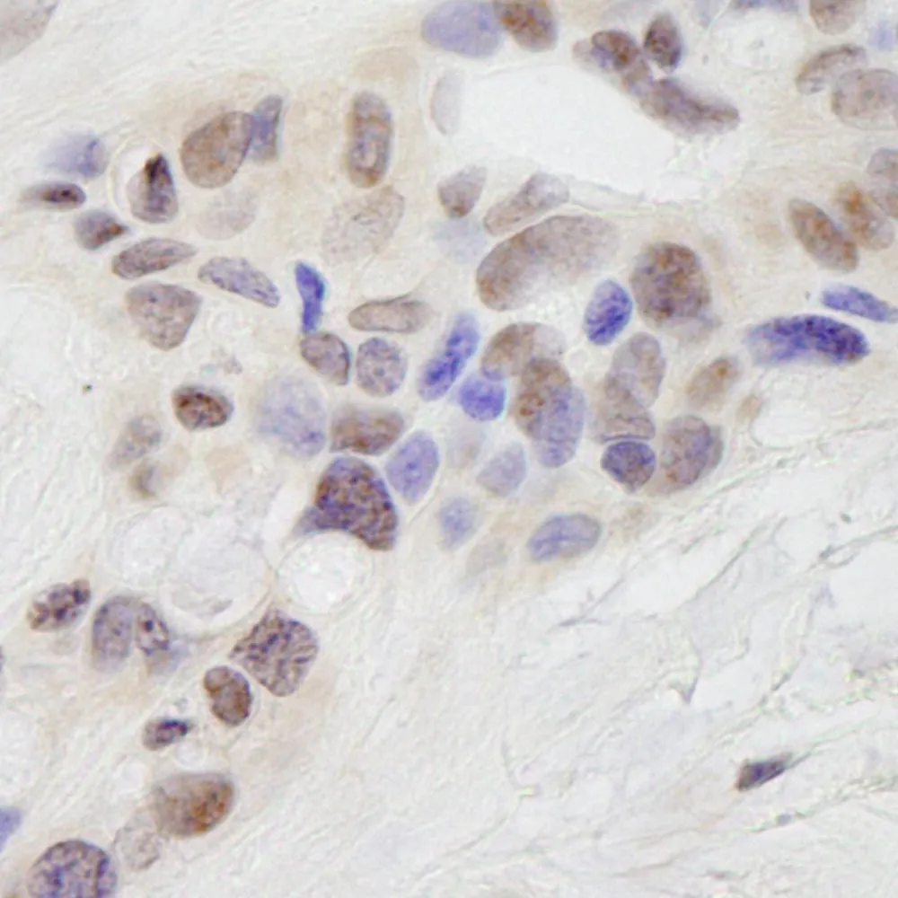 Rabbit anti-STAT6 IHC Antibody, Affinity Purified