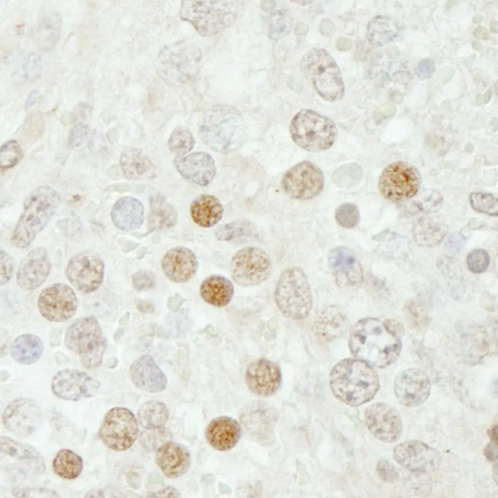 Rabbit anti-SMARCB1/SNF5 IHC Antibody, Affinity Purified