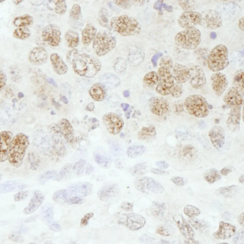 Rabbit anti-CPSF73 IHC Antibody, Affinity Purified