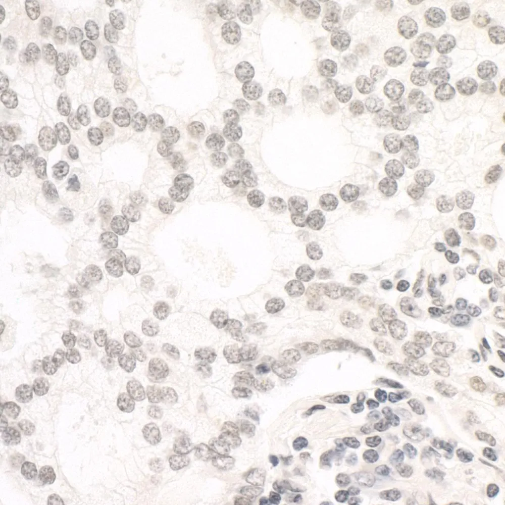 Rabbit anti-ARID1B IHC Antibody, Affinity Purified
