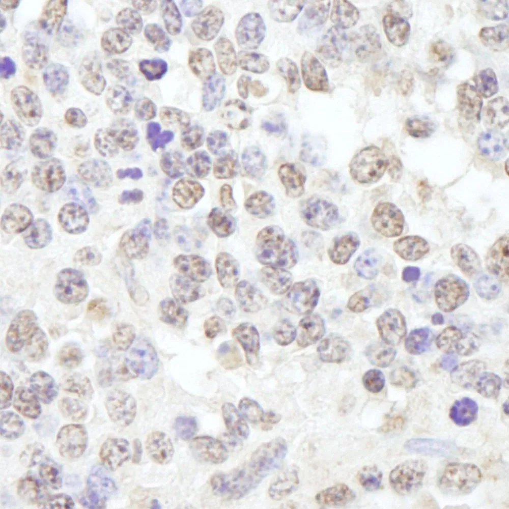 Rabbit anti-USP47 IHC Antibody, Affinity Purified