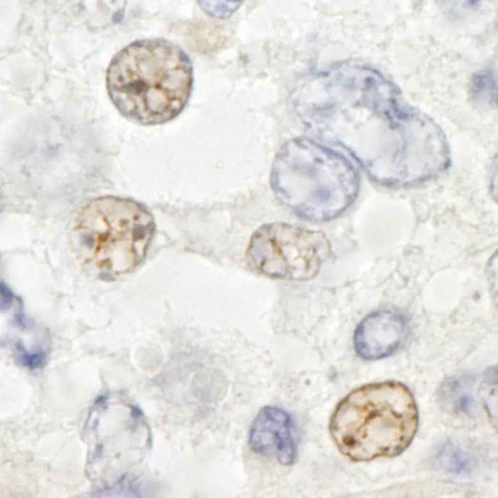 Rabbit anti-DDX46 IHC Antibody, Affinity Purified