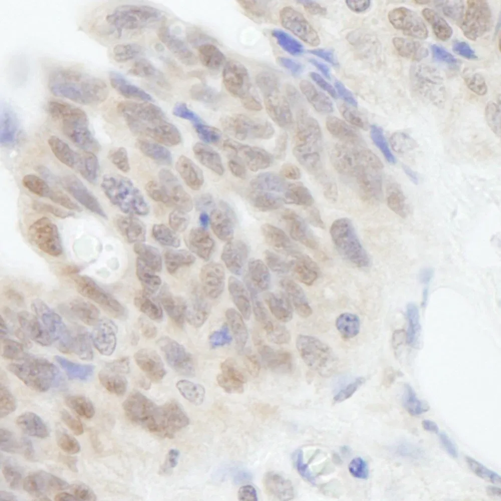 Rabbit anti-ABI1 IHC Antibody, Affinity Purified