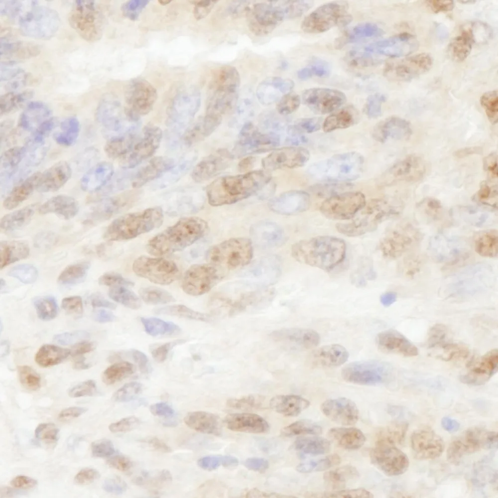 Rabbit anti-PolD3/p66 IHC Antibody, Affinity Purified