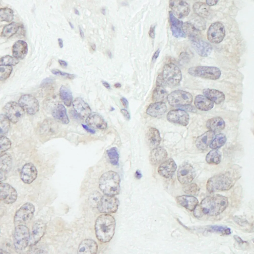 Rabbit anti-GTF3C1/TFIII220 IHC Antibody, affinity purified
