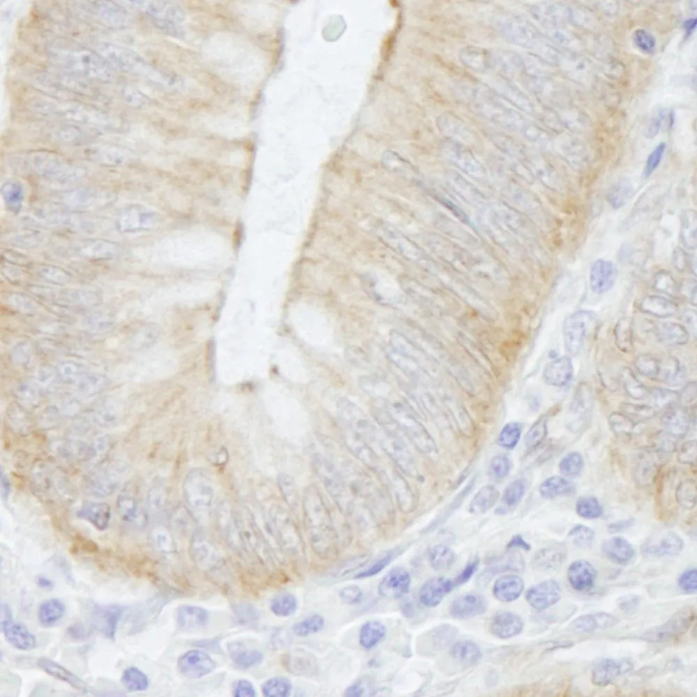 Rabbit anti-SPTAN1/Alpha II-spectrin IHC Antibody, affinity purified