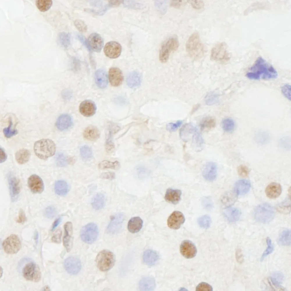 Rabbit anti-BRF1 IHC Antibody, Affinity Purified