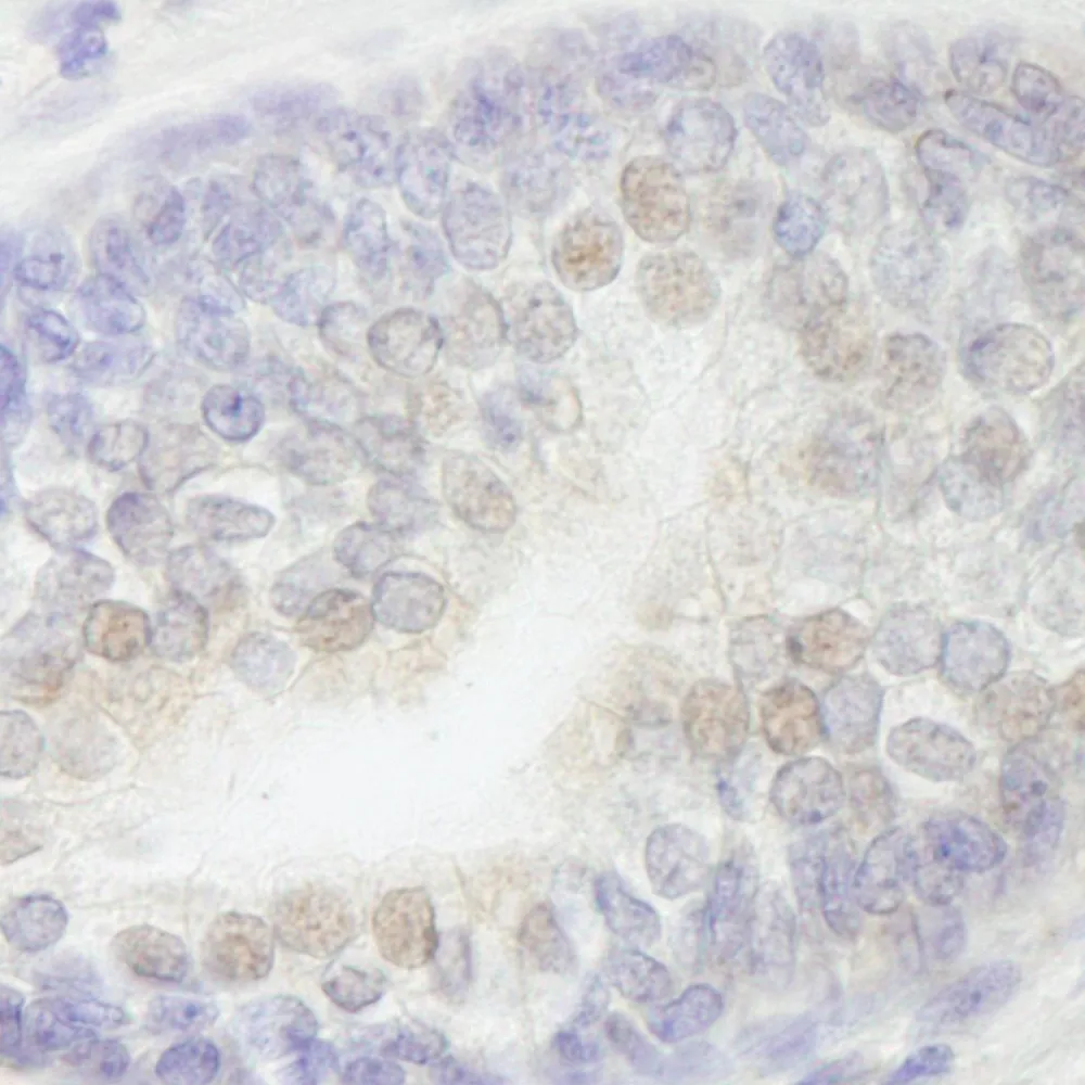 Rabbit anti-RBM27 IHC Antibody, Affinity Purified