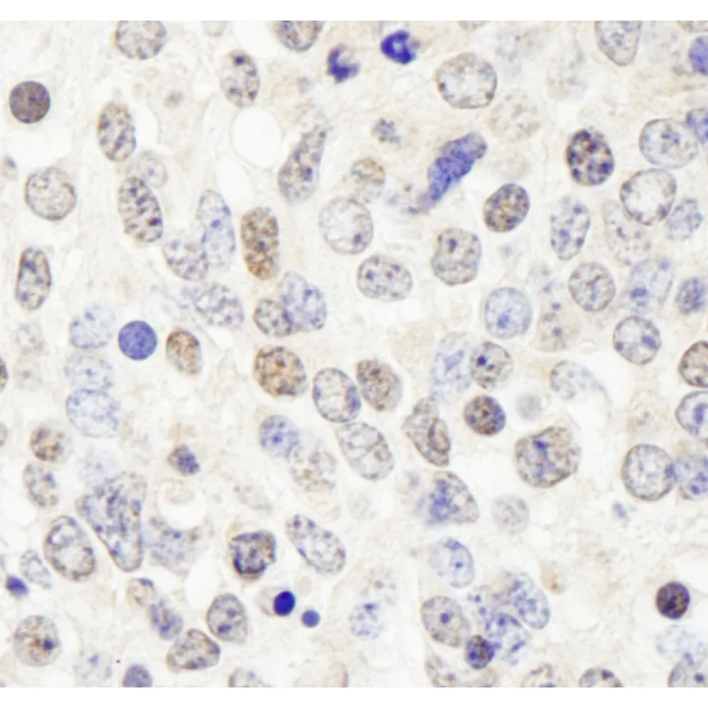 Rabbit anti-HDAC7 IHC Antibody, Affinity Purified