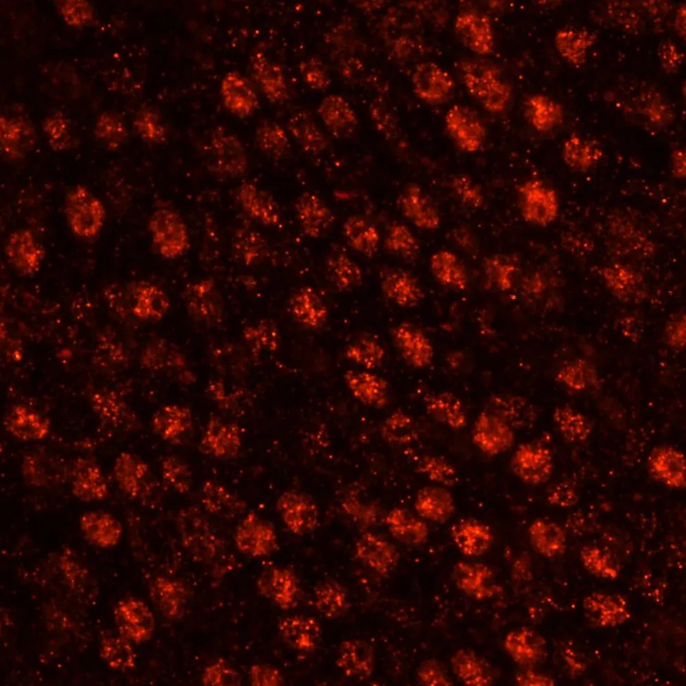 Rabbit anti-SART3/TIP110 IHC Antibody, Affinity Purified