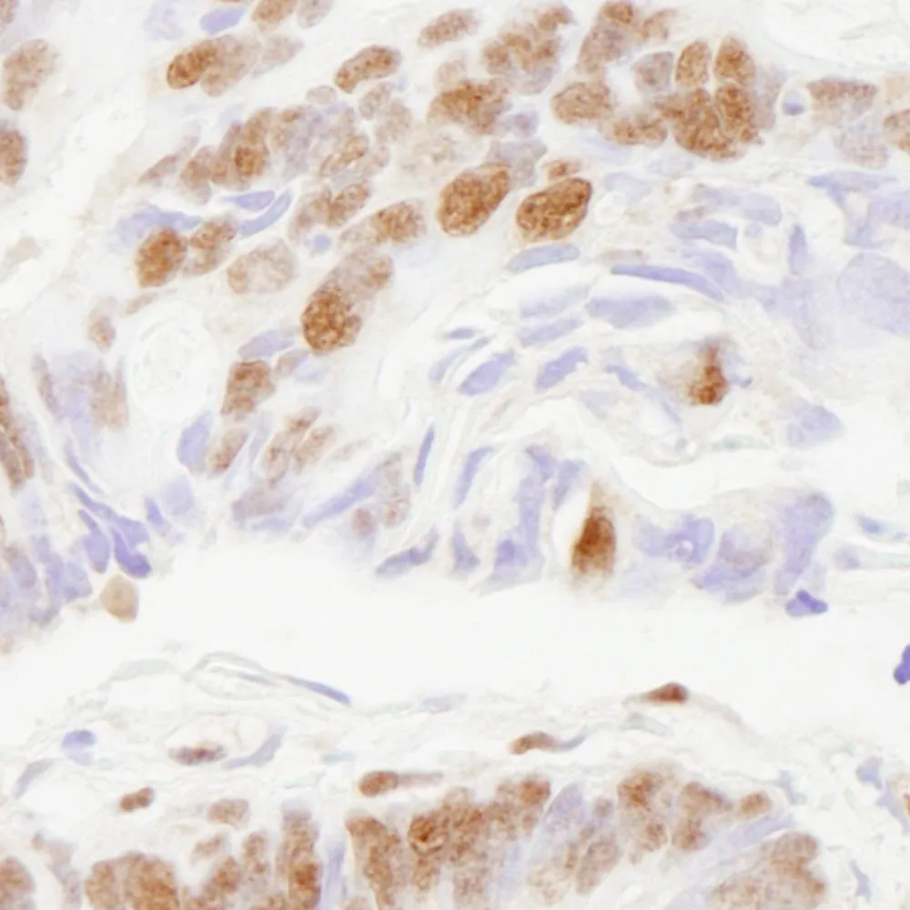Rabbit anti-ZNF295 IHC Antibody, Affinity Purified