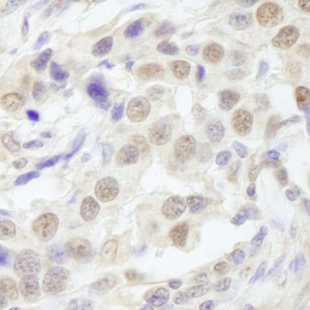 Rabbit anti-TAF6 IHC Antibody, Affinity Purified