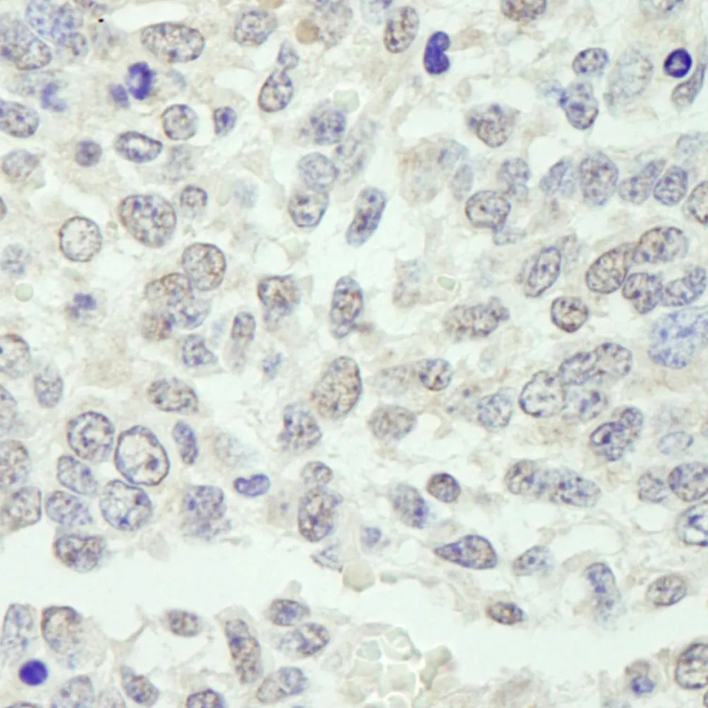 Rabbit anti-KPNA3 IHC Antibody, Affinity Purified