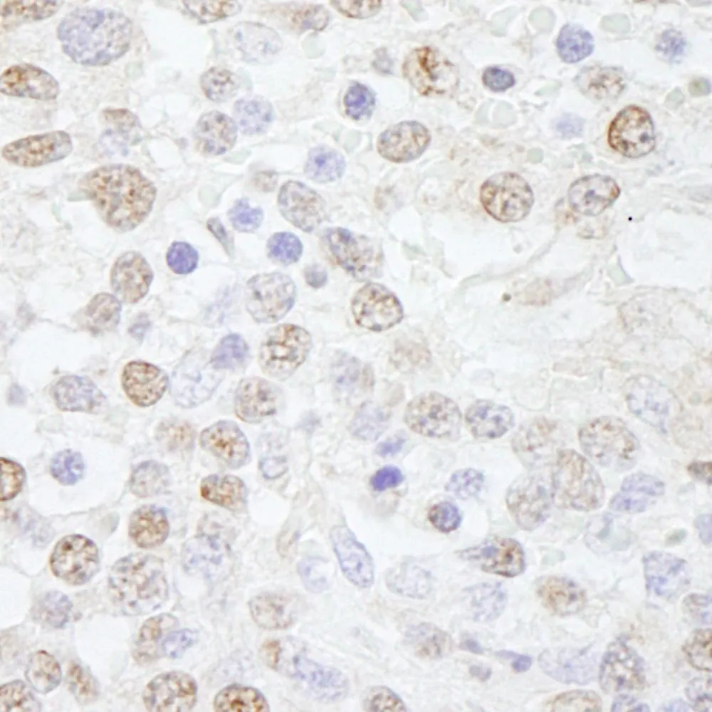 Rabbit anti-Pol Lambda IHC Antibody, Affinity Purified