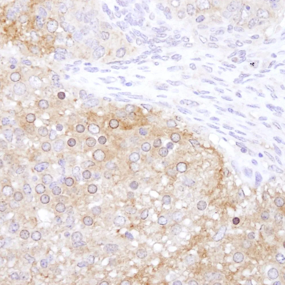 Rabbit anti-eEF2 Kinase IHC Antibody, Affinity Purified