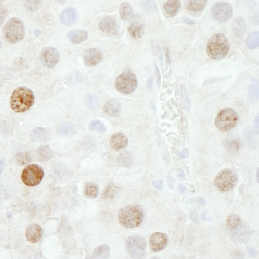 Rabbit anti-FOXK1 IHC Antibody, Affinity Purified