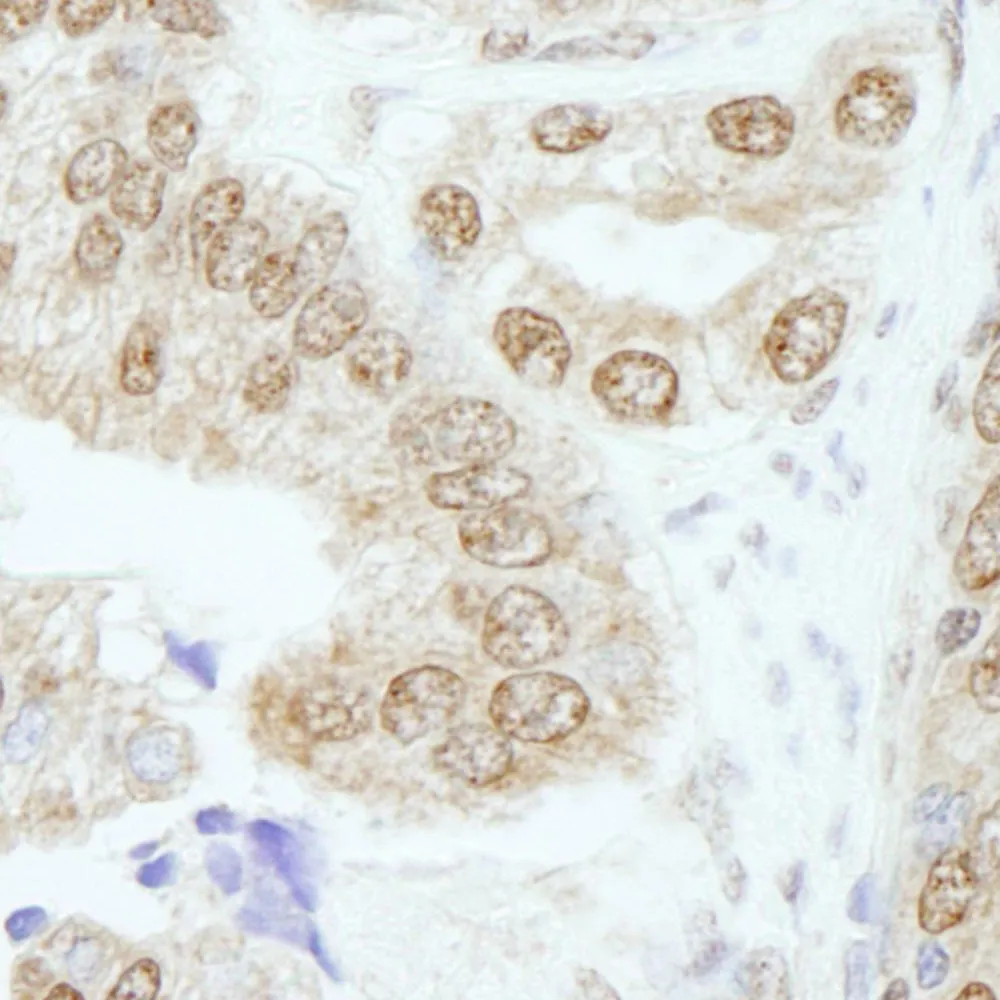 Rabbit anti-Cyclin E1 IHC Antibody, Affinity Purified