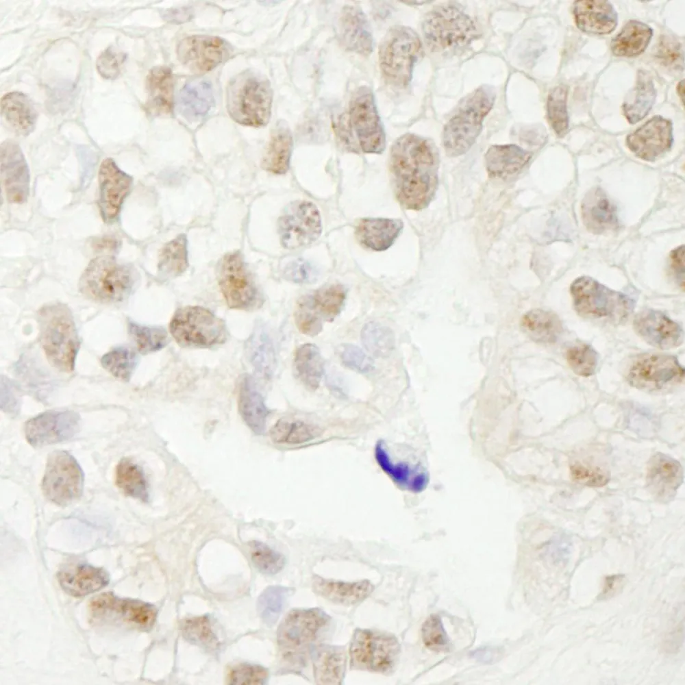 Rabbit anti-FBW7 IHC Antibody, Affinity Purified