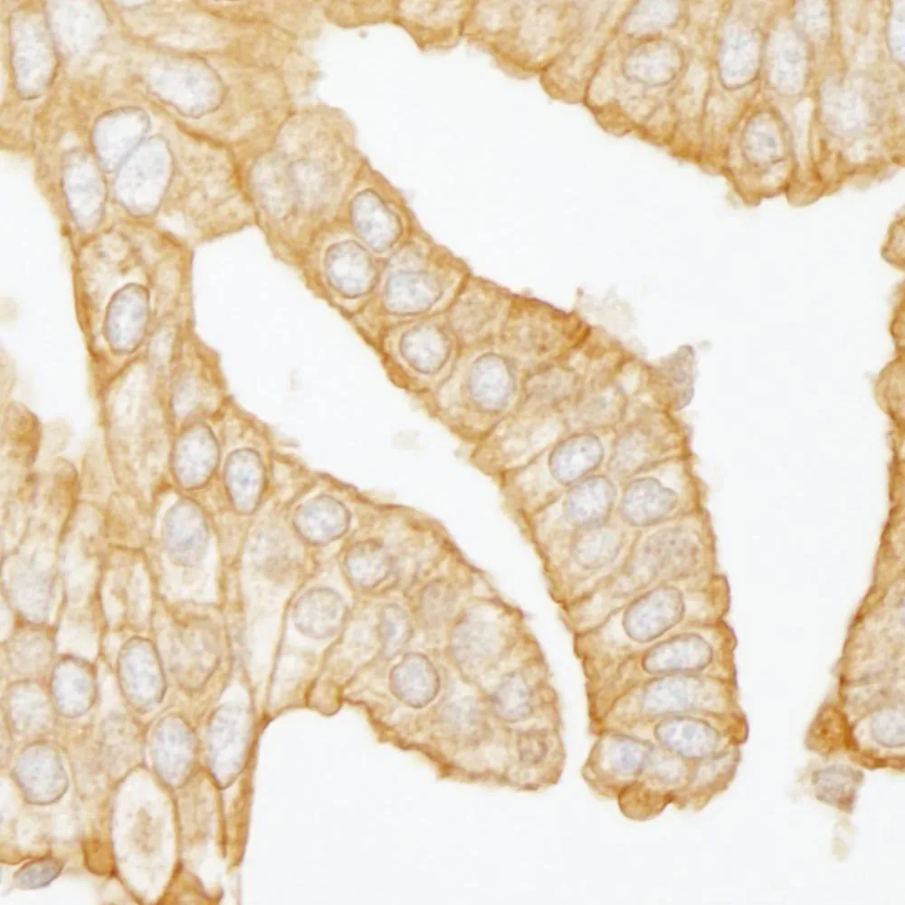 Rabbit anti-Filamin B IHC Antibody, Affinity Purified