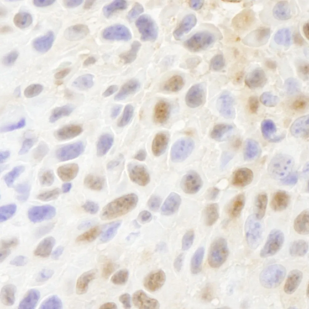 Rabbit anti-PARP10 IHC Antibody, Affinity Purified