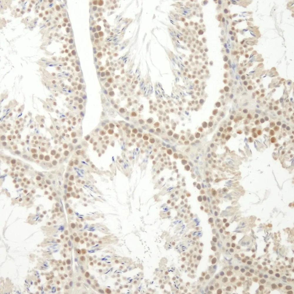 Rabbit anti-E1B-AP5 IHC Antibody, Affinity Purified