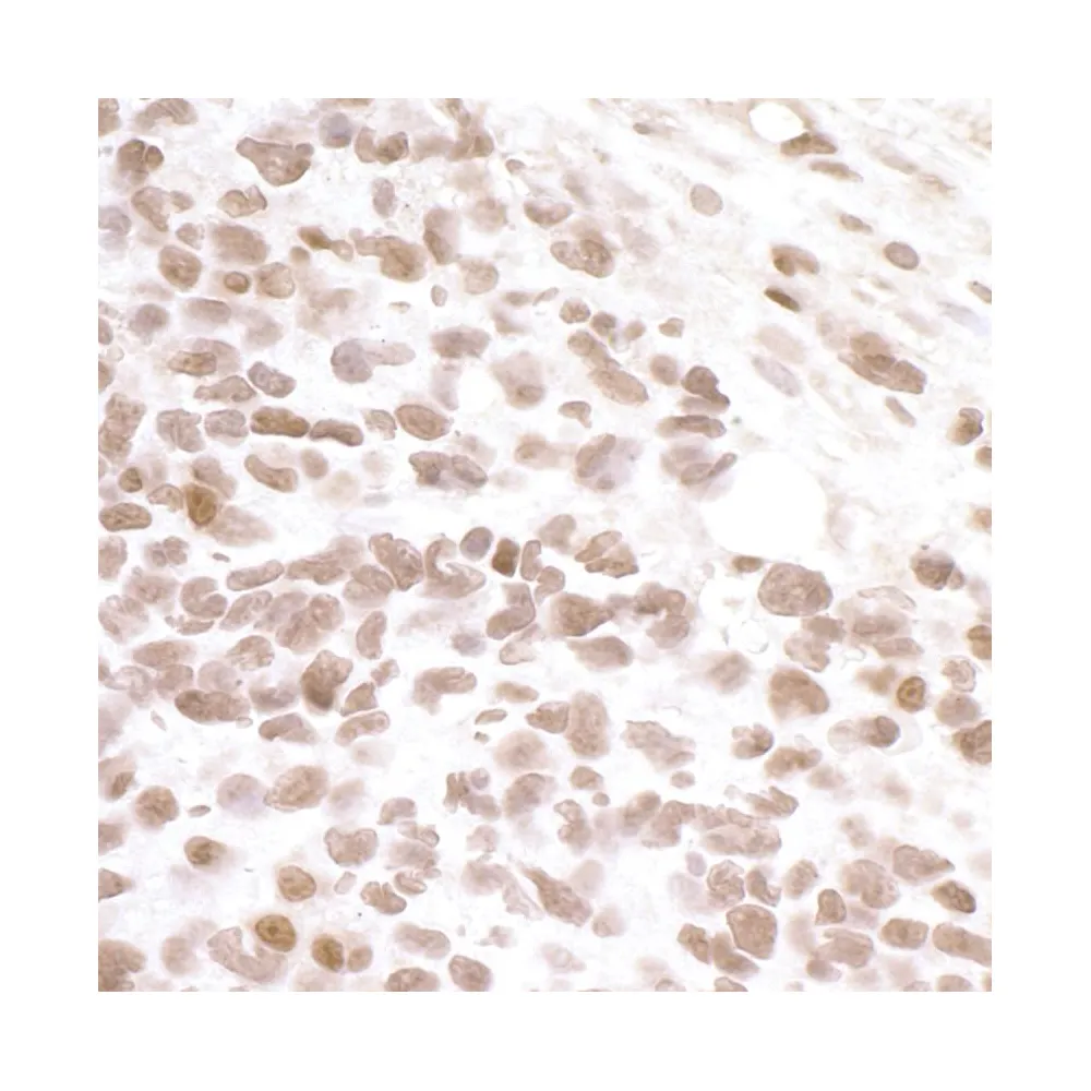 Rabbit anti-BRD4 IHC Antibody, Affinity Purified