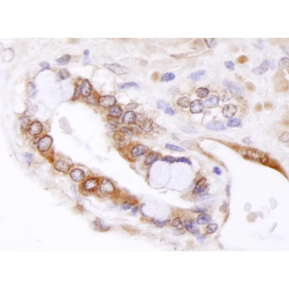 Rabbit anti-ABCB9 IHC Antibody, Affinity Purified
