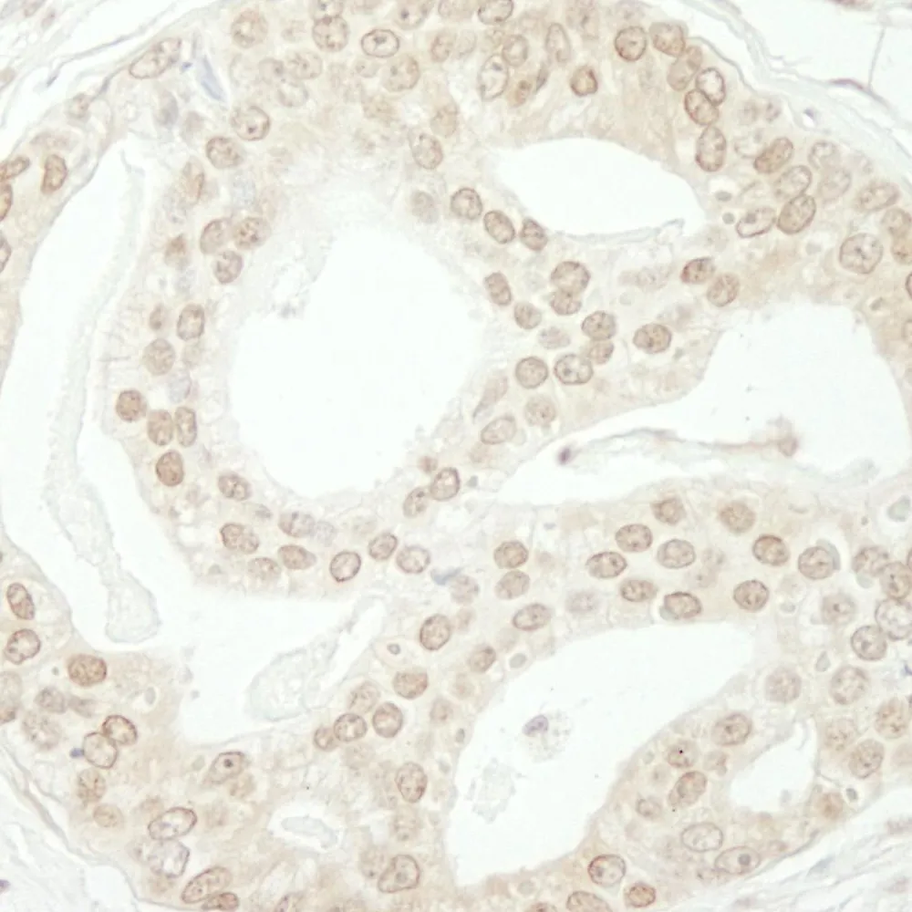 Rabbit anti-ZBTB40 IHC Antibody, Affinity Purified
