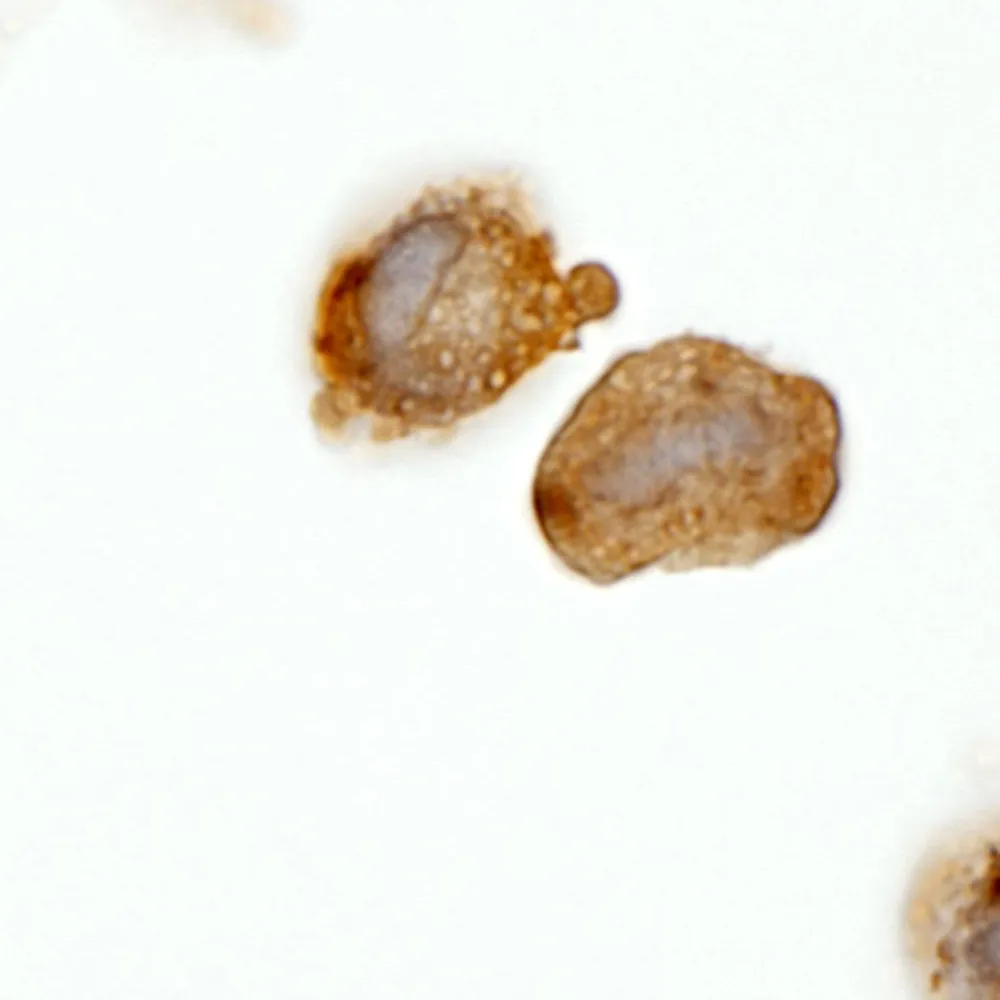 Rabbit anti-BCR IHC Antibody, Affinity Purified
