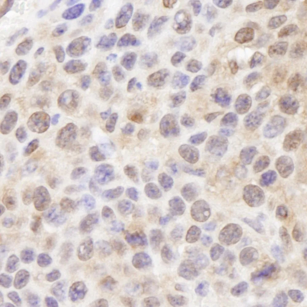 Rabbit anti-Ubiquitin IHC Antibody, Affinity Purified