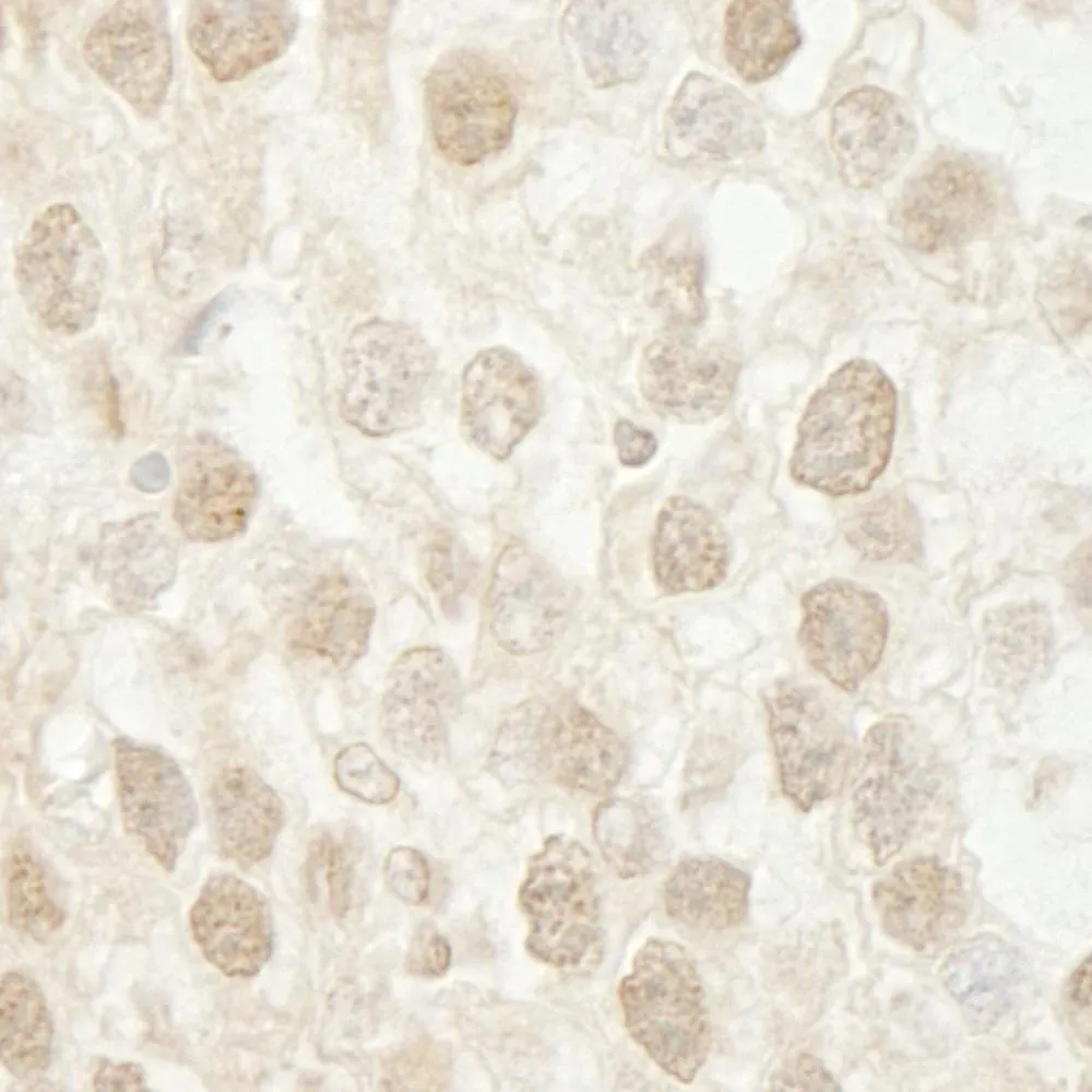 Rabbit anti-MTA3 IHC Antibody, Affinity Purified
