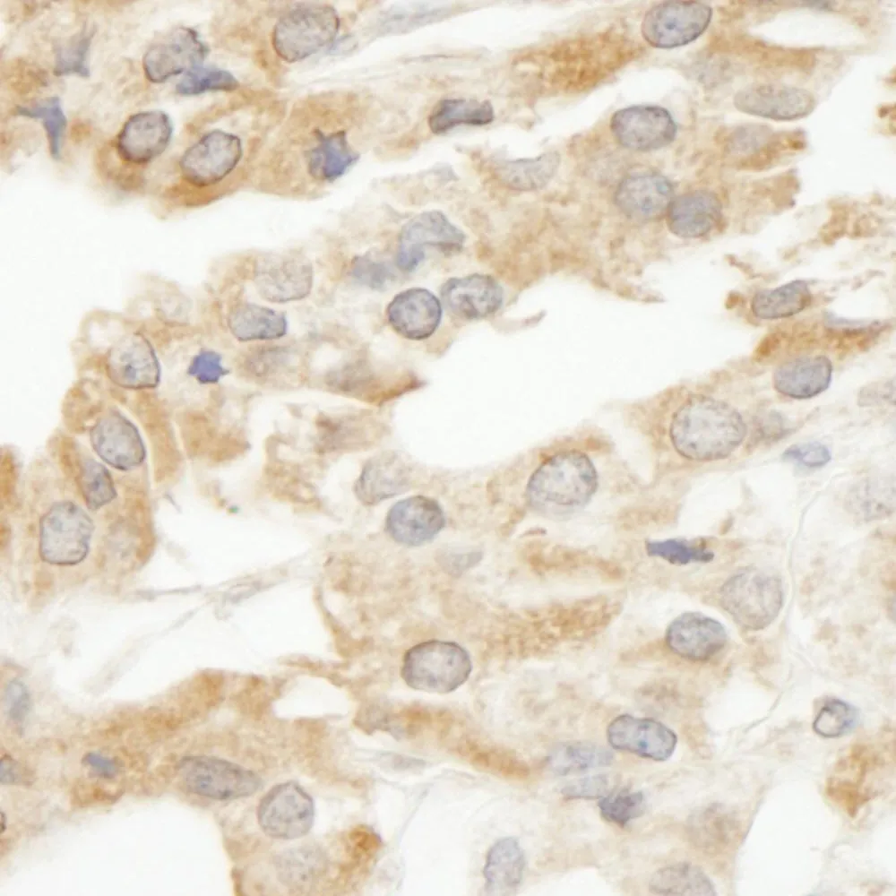 Rabbit anti-ABCF2 IHC Antibody, Affinity Purified