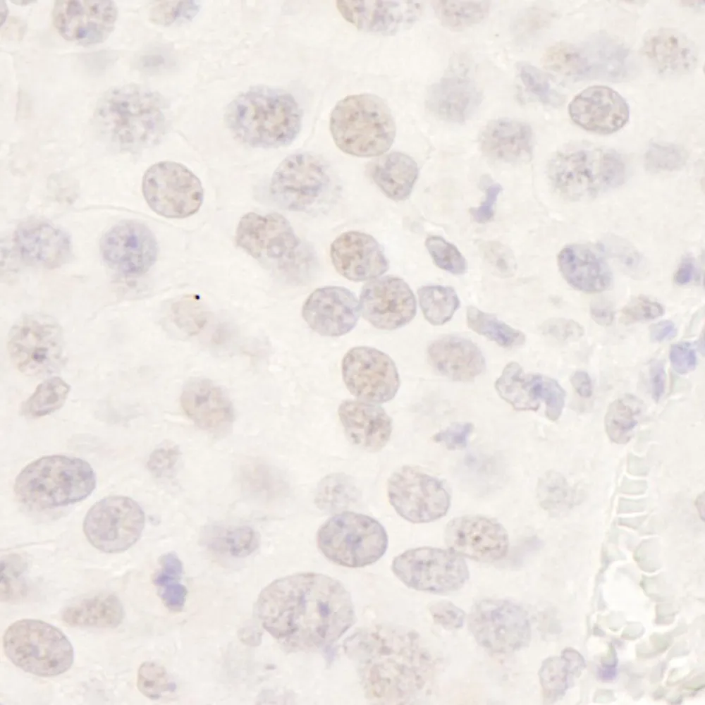 Rabbit anti-HDAC3 IHC Antibody, Affinity Purified