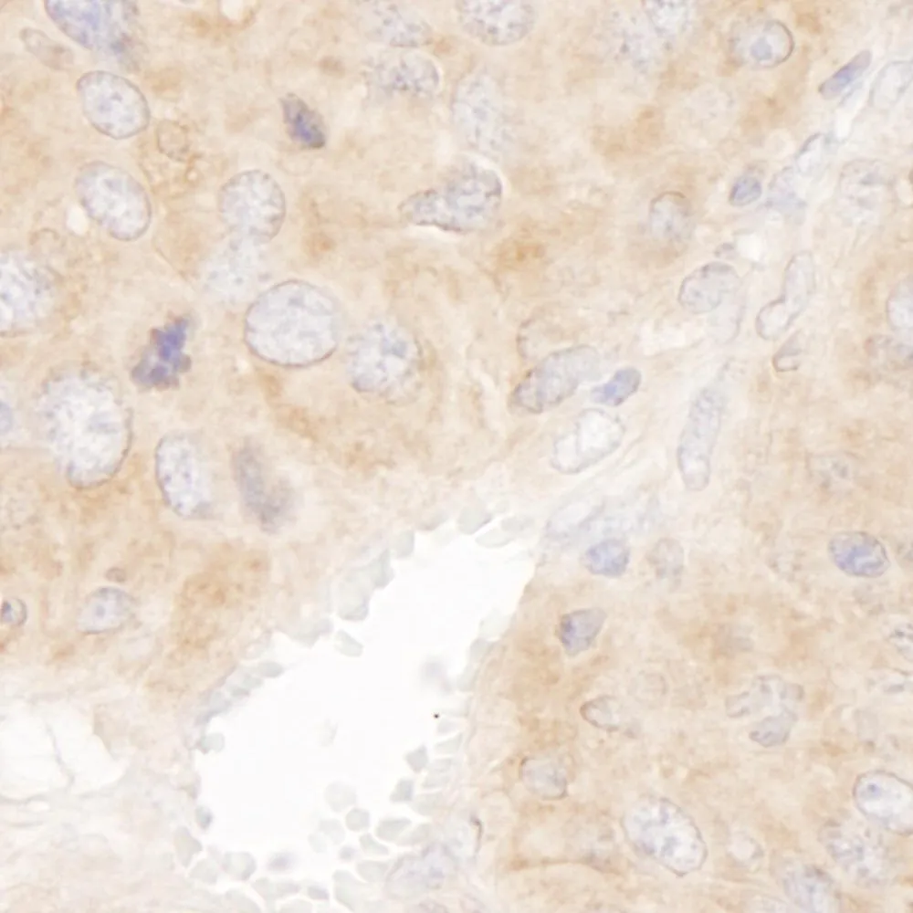Rabbit anti-SNX1 IHC Antibody, Affinity Purified