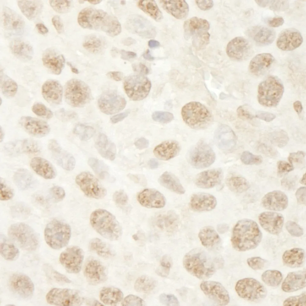 Rabbit anti-BRG1/SMARCA4 IHC Antibody, Affinity Purified