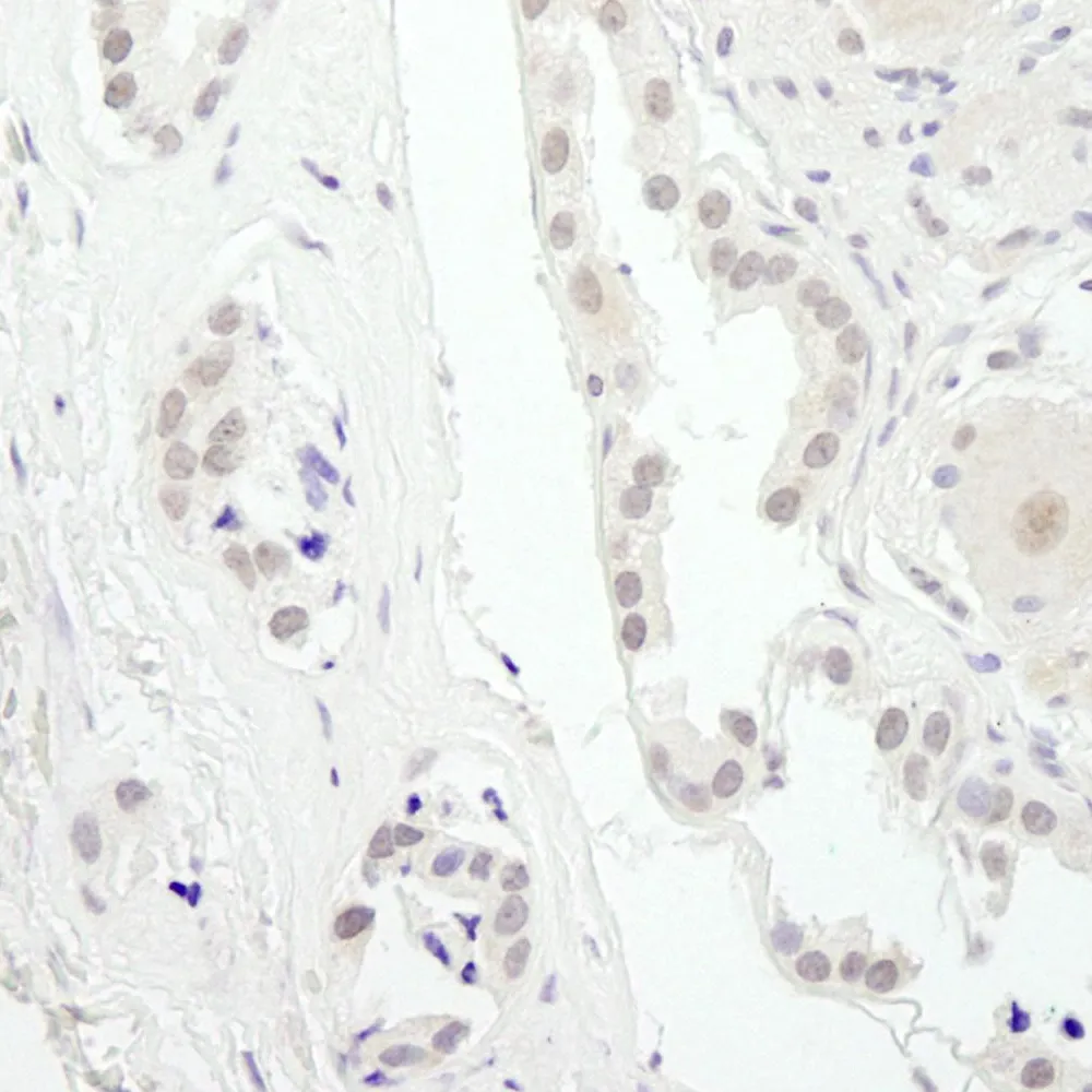 Rabbit anti-USP34 IHC Antibody, Affinity Purified