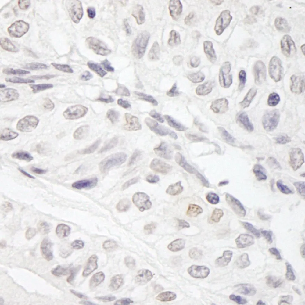 Rabbit anti-JARID1A/RBP2 IHC Antibody, affinity purified