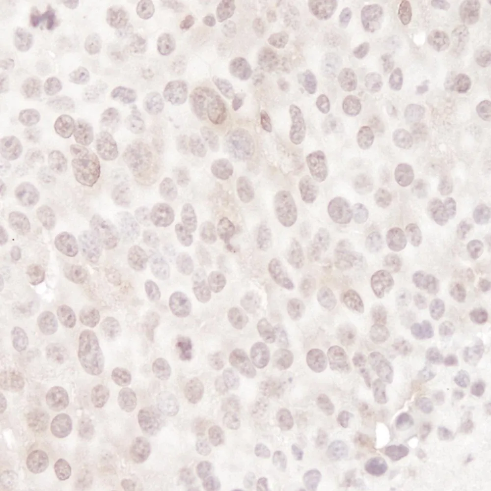 Rabbit anti-Gemin4 IHC Antibody, Affinity Purified