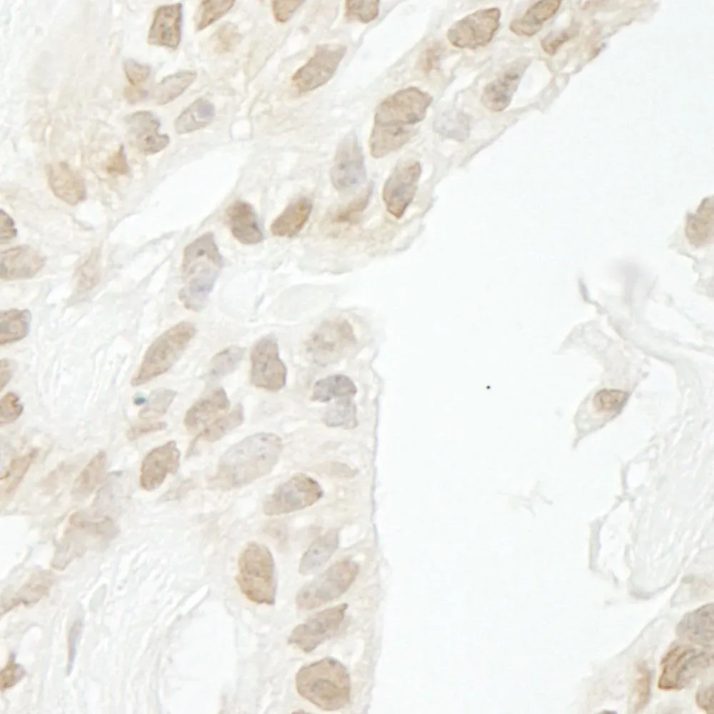 Rabbit anti-PPP1CC IHC Antibody, Affinity Purified
