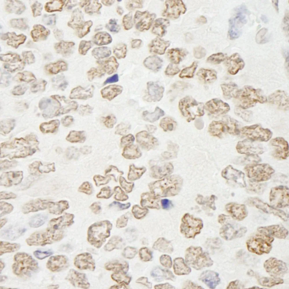 Rabbit anti-PRMT6 IHC Antibody, Affinity Purified
