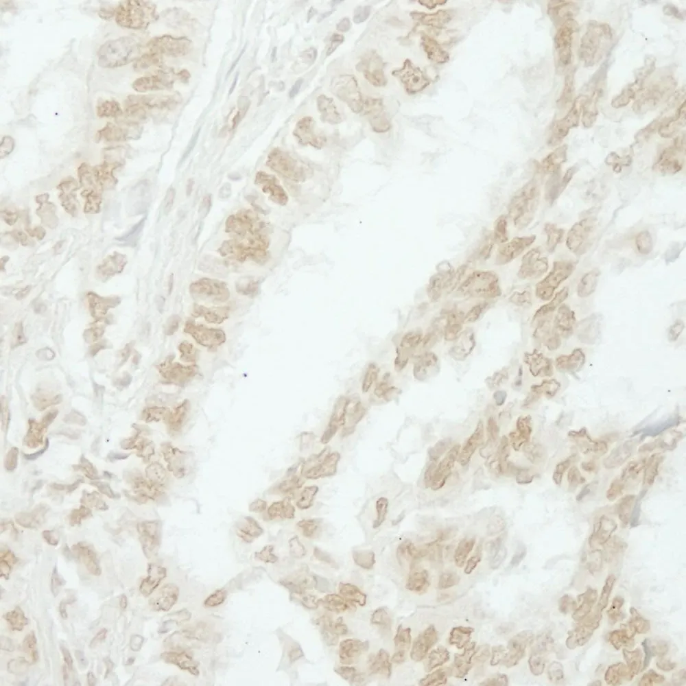 Rabbit anti-MKRN2 IHC Antibody, Affinity Purified