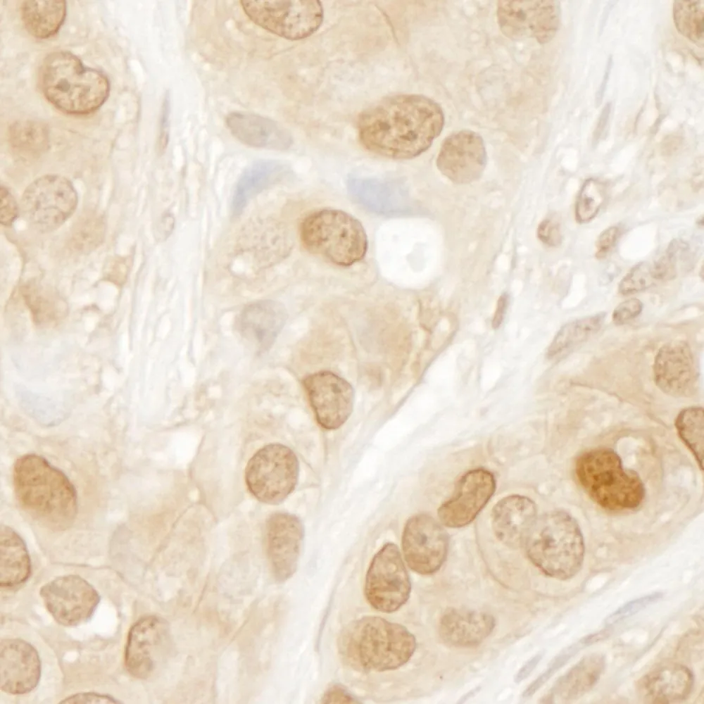Rabbit anti-AKT1 IHC Antibody, Affinity Purified