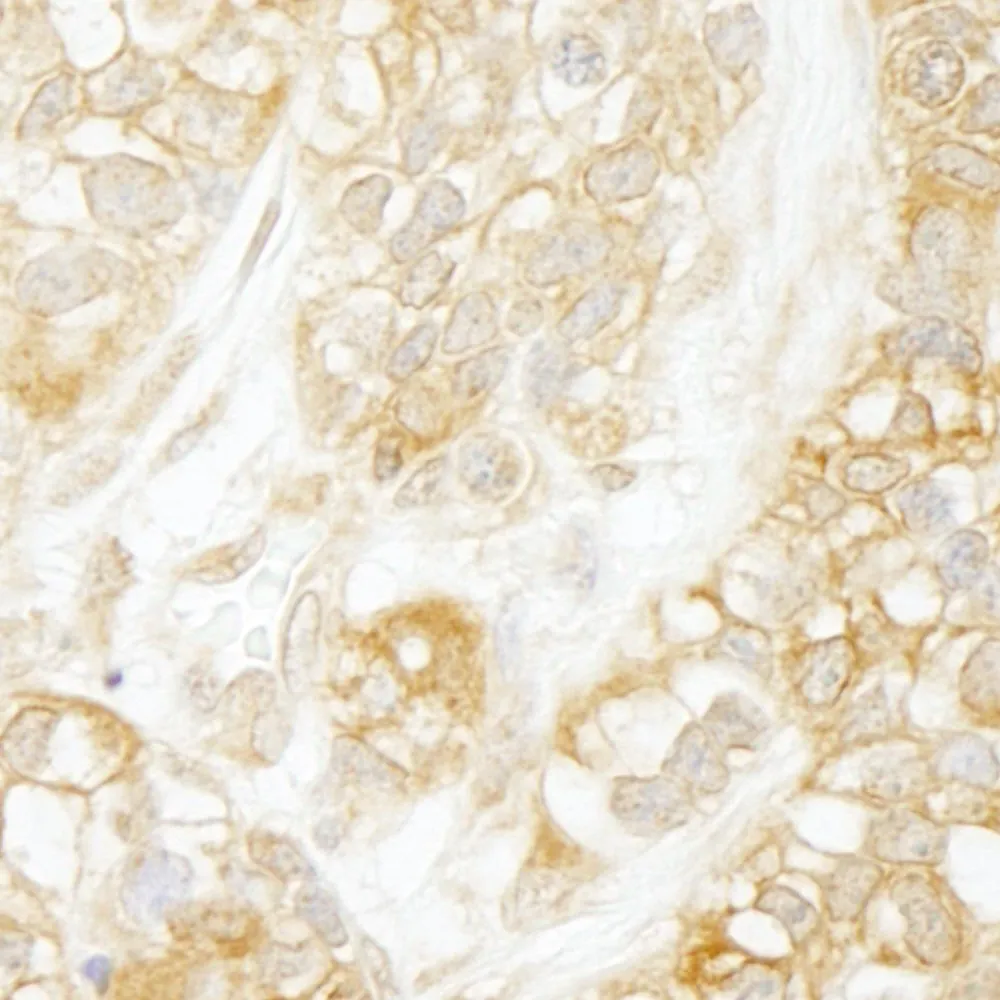 Rabbit anti-RelA IHC Antibody, Affinity Purified