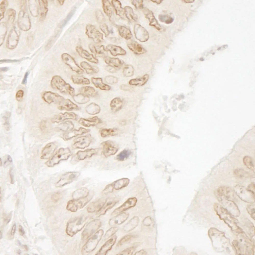 Rabbit anti-FALZ/BPTF IHC Antibody, Affinity Purified
