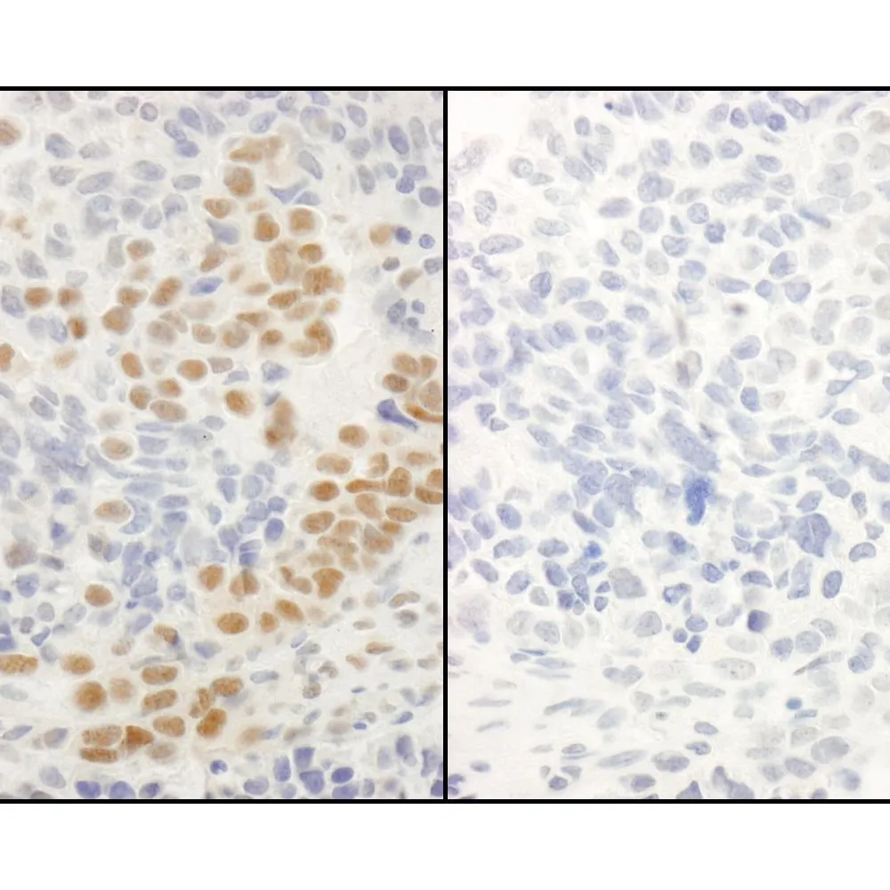 Rabbit anti-Phospho RelA (S536) IHC Antibody, Affinity Purified