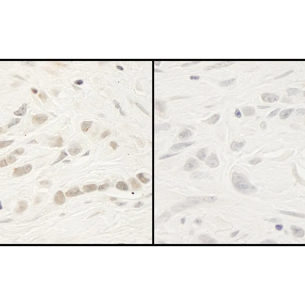 Rabbit anti-Phospho RelA (S468) IHC Antibody, Affinity Purified