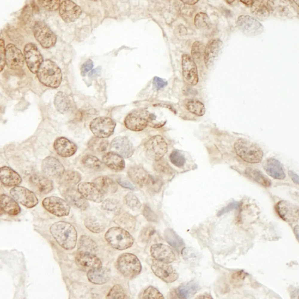 Rabbit anti-C1orf55 IHC Antibody, Affinity Purified